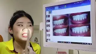 Intraoral Camera With Screen Review