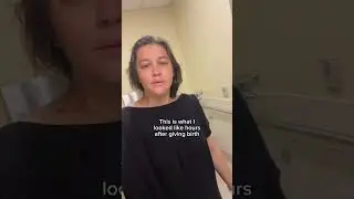 What I looked like after giving birth