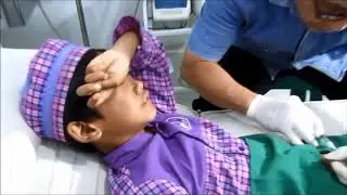 KEPONAKAN DI SUNAT LASER ngeriiiiiiiiiiiii 