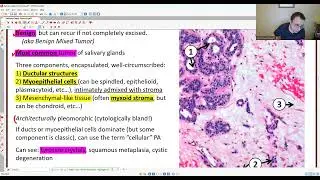 H&N PATHOLOGY: SALIVARY GLAND TUMORS 2