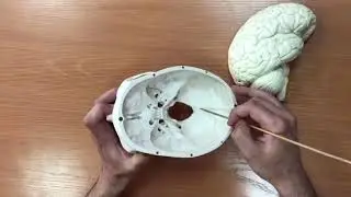 Оболочки головного мозга,синусы,цистерны