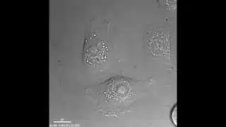 Keratinocyte cell movements