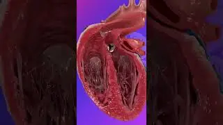The Congenital Heart Defect  #healthcareeducation #medicalanimation #3danimation