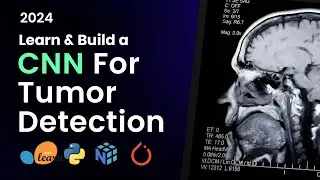 Build a CNN from Scratch to Detect and Localize Brain Tumors Using MRI Scans | Python, AI, ML