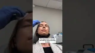 I Got Botox for the First Time: What to Expect