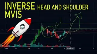 MVIS (microvision) CHART ANALYSIS [short term BOOM Alert] with price targets