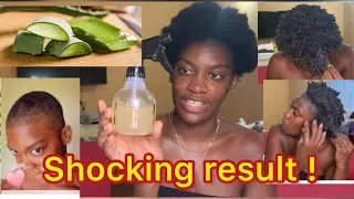 Extreme Aloe Vera Deep Conditioning For Massive Hair Growth..Shocking Result