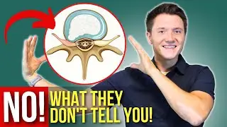 Learn The Difference Between Bulging Disc and Disc Herniation!