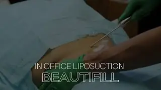 Beautifill Explained