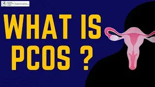 PCOS Uncovered: Understanding the Complexities of Polycystic Ovarian Syndrome | PCOS