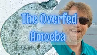 Microsafari   The Overfed Amoeba