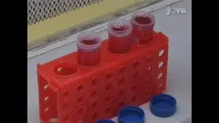 Invasion of Human Cells by a Bacterial Pathogen