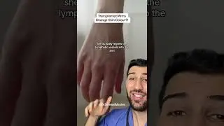 Transplanted Arms Change Skin Colour?! 