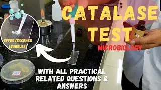Catalase Test | Microbiology Practical | Related All Q&As | The Chill Medico