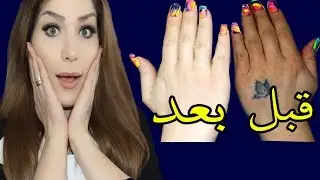 وصفة لتبييض البشرة اليد في وقت سريع ومضمون 100%