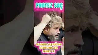 Problems You May Encounter While Using Prosthetic Hair