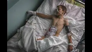 9yo Vladik sees his mother killed buy Ukraine Shelling: Donetsk Protest