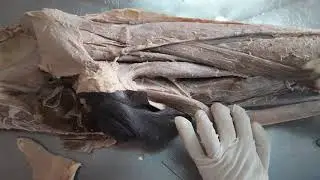 Medial compartment of thigh