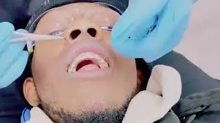 Getting my wires change…￼