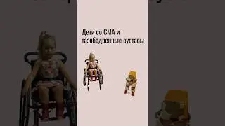Дети со СМА и тазобедренные суставы