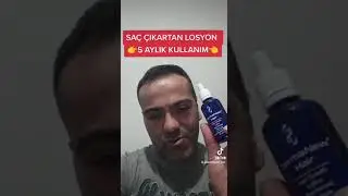 SAÇ ÇIKARTAN LOSYON