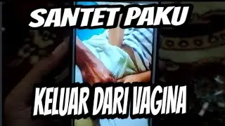 SANTET PAKU PECAH PERAWAN DI VAGINA
