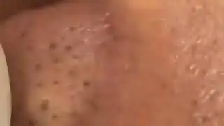чистыт лицо он черный точек