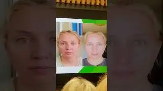 Пептиды. Комплекс ProCeuticals от Орифлэйм