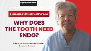 Root Canal or Extraction? How Dentists Decide