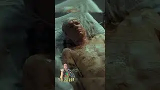 Танкист сгорел, но остался жив😳 