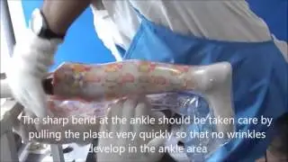 Articulated AFO Moulding Technique