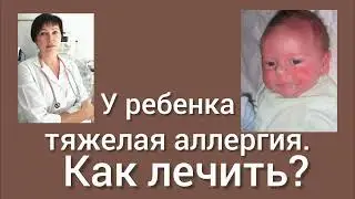 У ребенка тяжелая аллергия. Как лечить?