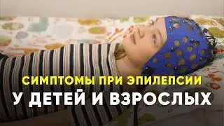Какие симптомы могут проявлятся при ЭПИЛЕПСИИ у ДЕТЕЙ и ВЗРОСЛЫХ 2