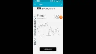 BLE Heart Rate Monitor Max30003 Wearble Health Monitor Project