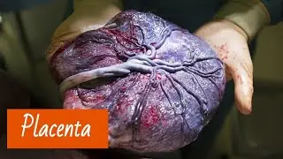 Le Placenta: définition, structure, rôle, pathologie | cours pour sage femme 1 er année