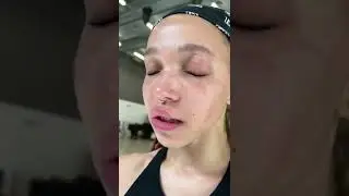 erasing fine lines with juliano nunes