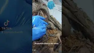 Anatomía básica del riñón humano