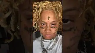 Trippie Redd tendo as tatuagens removidas 