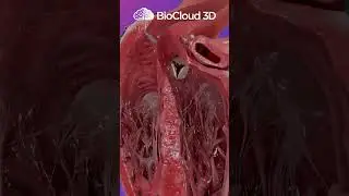 Interactive Method of Disease #healthcareeducation