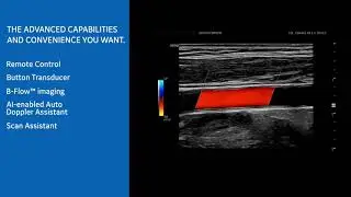 New LOGIQ P Series Ultrasound: Making Vascular Studies Efficient