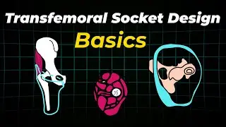 Transfemoral Prosthetic Sockets Explained: What every Amputee & Clinician Should Know!