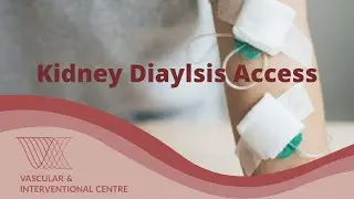 What is Kidney Dialysis? How is an access formed?