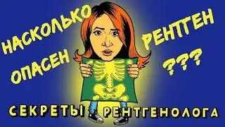 Смертелен ли рентген? Врач-рентгенолог о своей работе. Работа не волк.