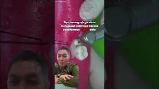 Lebih baik diambil sekarang giginya daripada sakit dikemudian hari.