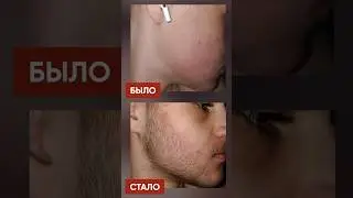 БОРОДА С НУЛЯ с помощью лосьона mr.Volos