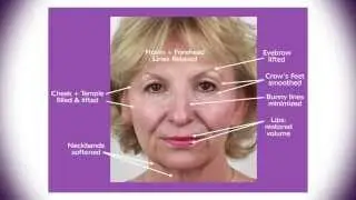 Wendie's Soft Lift Makeover
