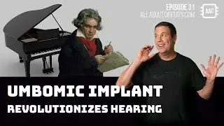 AAC Spotlight | Ep. 31 | UmboMic Implant Revolutionizes Hearing
