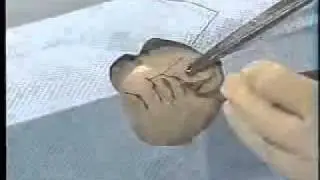 05   basic suturing techniques