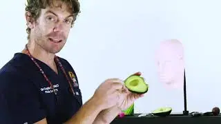 Using an Avocado to demonstrate Buccal Fat Pad Safety