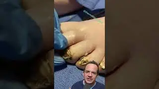 DOCTOR REACTS: ARE THESE TOENAILS DEAD? 😱 
